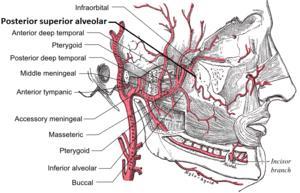 Posterior superior alveolar artery