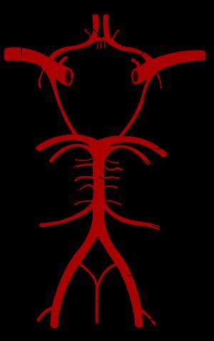 Arteria basilar