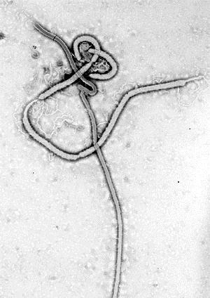 Ébola (virus)