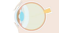 Senso della vista: L'occhio, sezione trasversale (Medio)