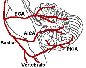 Arteria cerebelosa superior