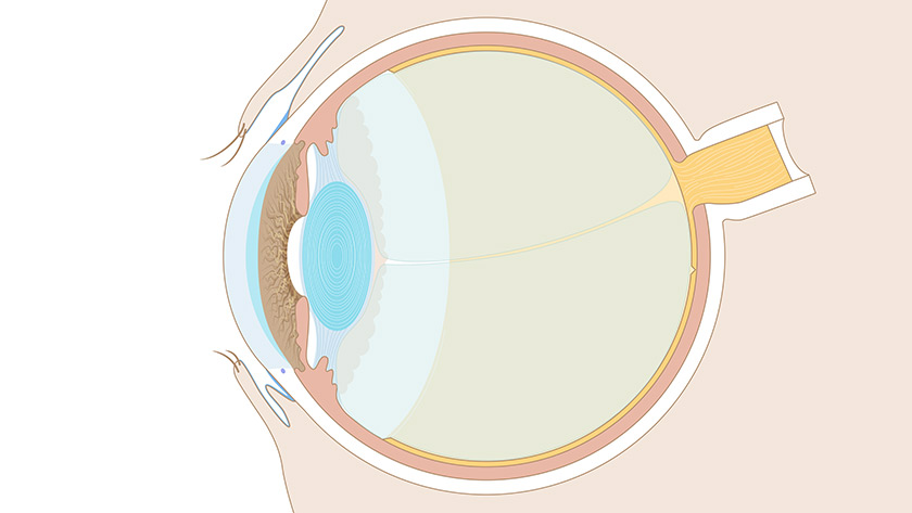 Visual system: The eye, cross section (Normal)