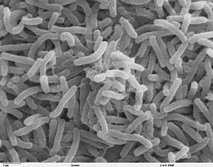 Teoría microbiana de la enfermedad