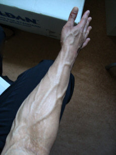 Antebrazo