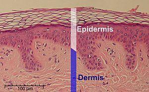 Epidermis