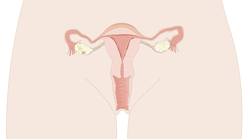 Female reproductive system, front view (Normal)