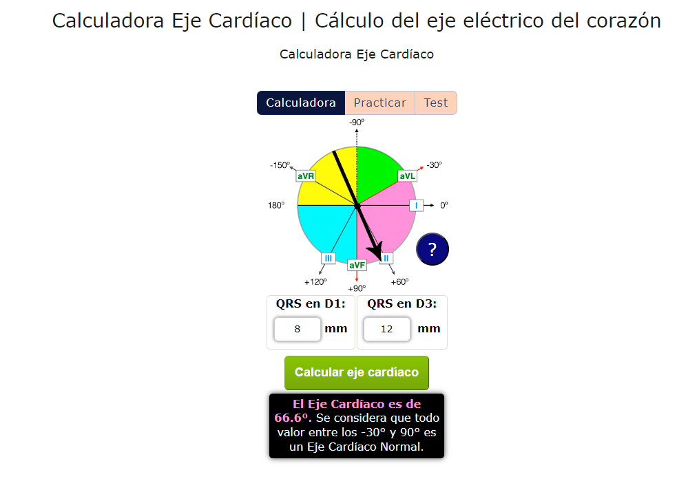 Calculadora de Eje Cardiaco