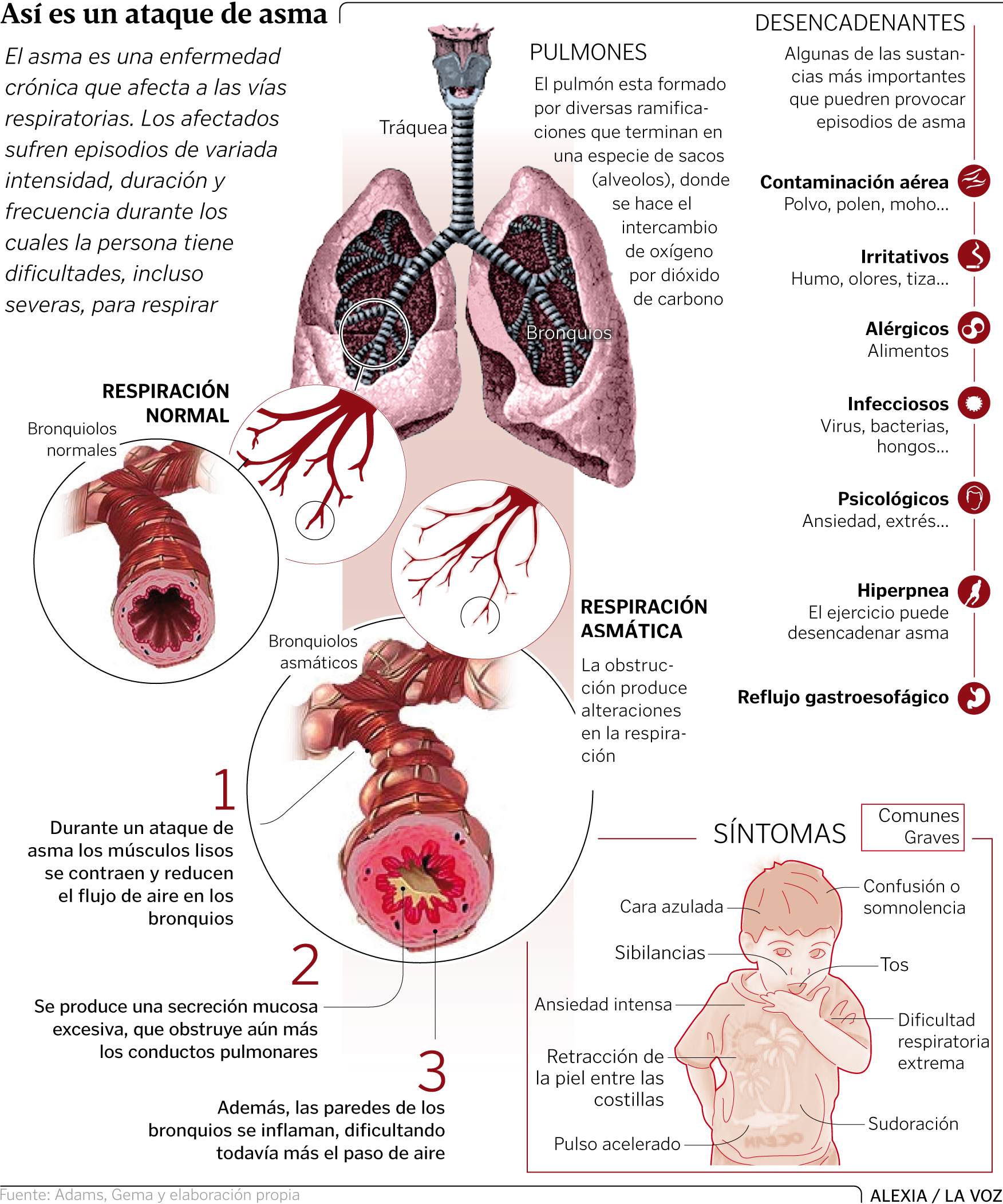 Así es un ataque de asma (Infografía, La Voz de Galicia)