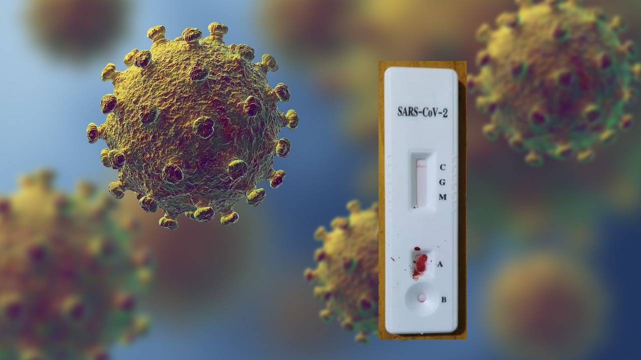 Test de diagnóstico del coronavirus SARS CoV-2