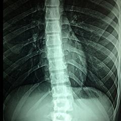 Estructura externa e interna de la médula espinal