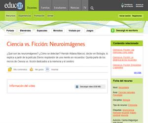 Neuroimágenes