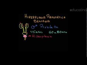 Hiperplasia Prostática Benigna (HPB)