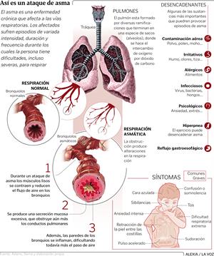 Así es un ataque de asma (Infografía de La Voz de Galicia)